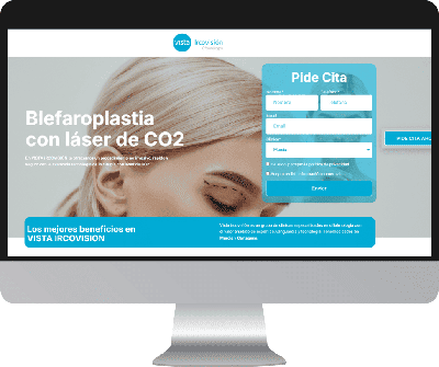 Diseño de landing page para clínica oftalmológica Irco Vision